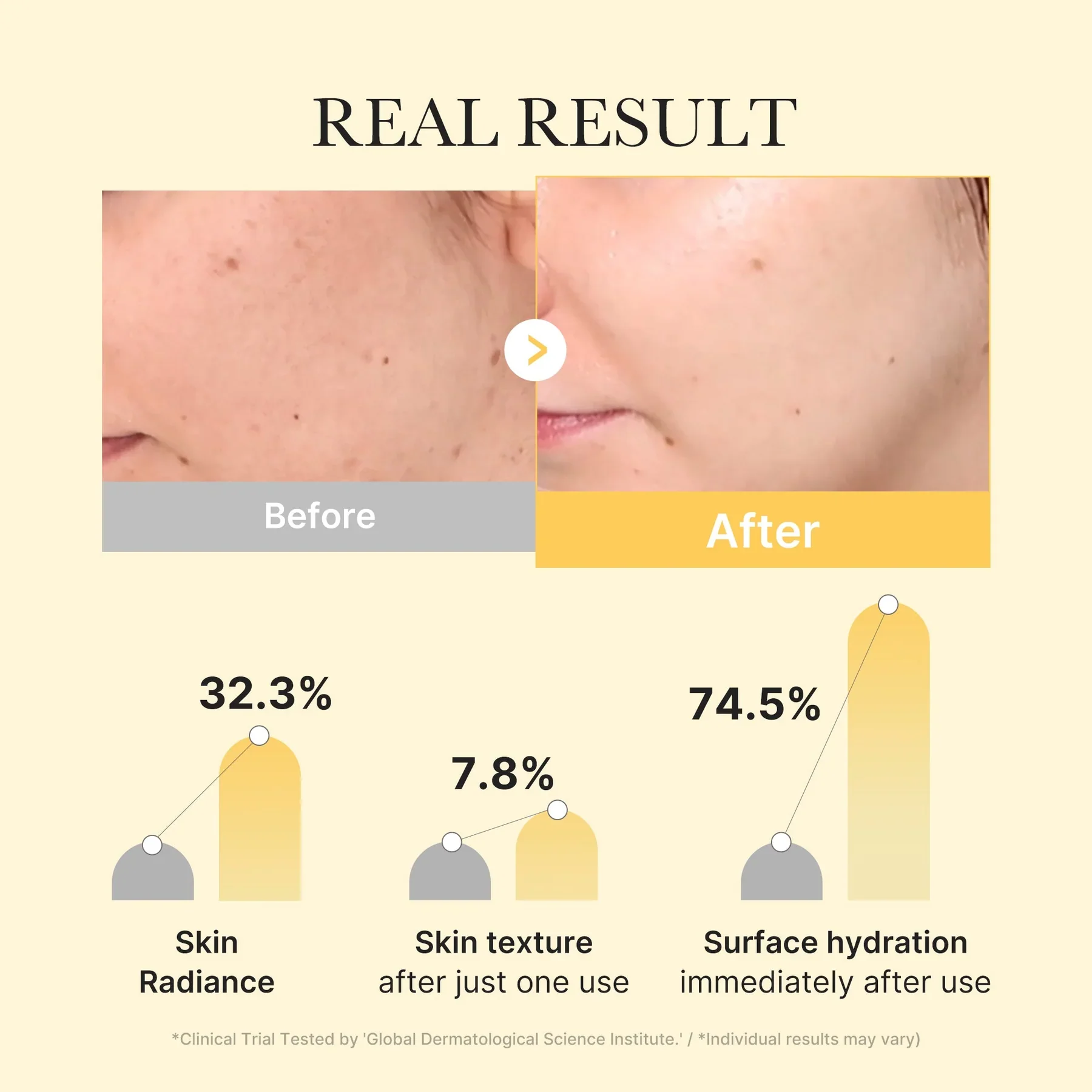MEDICUBE Kojic Acid Turmeric Brightening Gel Mask (4ea) - Image 3