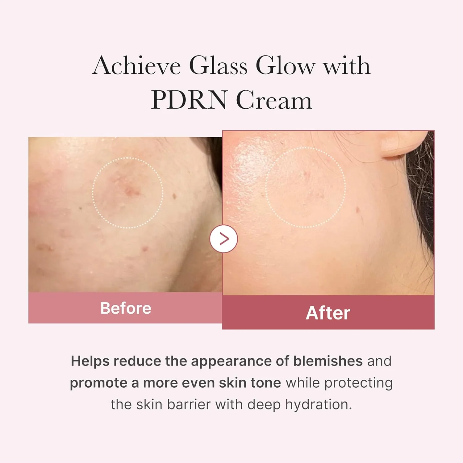 MEDICUBE PDRN Pink Hyaluronic Moisturizing Cream 50ml - Image 3