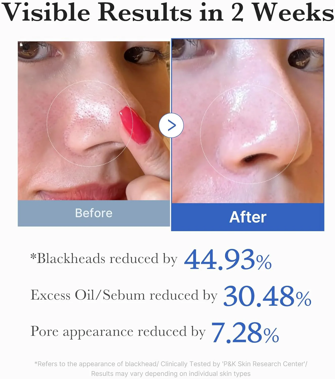 MEDICUBE Zero Pore Pad 2.0 (70pads) - Image 5